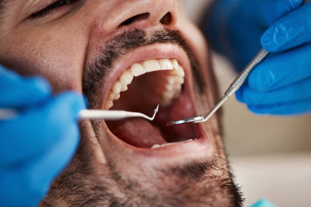 Best Weekend Emergency Dentist in Mohnton, PA